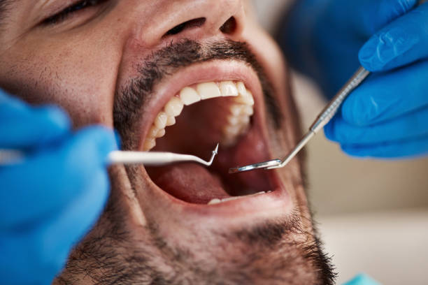 Best Emergency Dental Care for Broken or Chipped Teeth in Estancia, NM